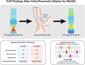 Functional Lumen Imaging Probe Measurement Post-Pneumatic Dilation in Clinically Relevant Esophagogastric Junction Outlet Obstruction.
