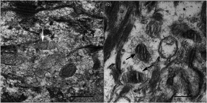 Evaluation of canine epidermis and keratinocytoids (keratinocytic organoids) by transmission electron microscopy.
