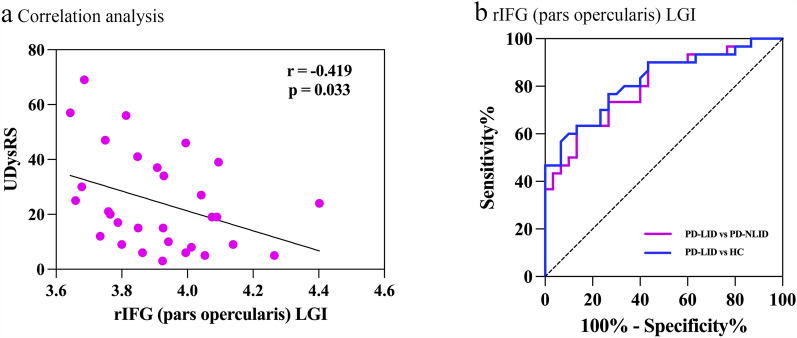 Altered Cortical Gyrification, Functional Connections, and Underlying Neurotransmitter Information in Patients with Parkinson's Disease with Levodopa-Induced Dyskinesia.