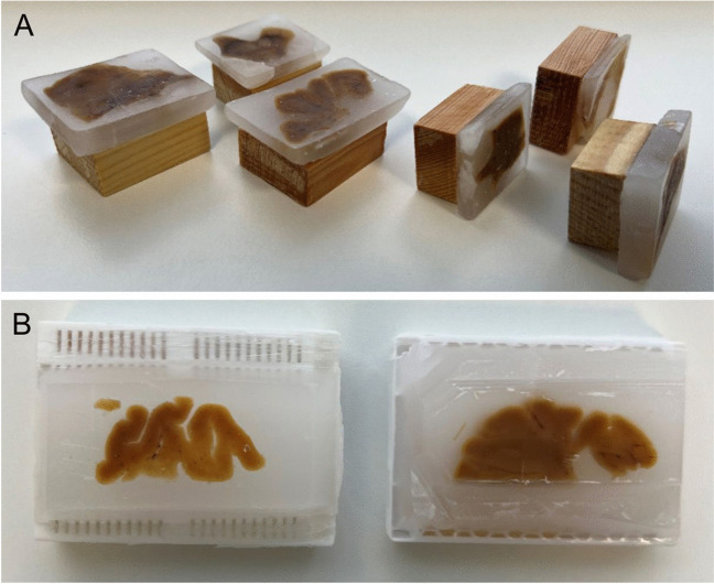 Application of microRNA In Situ Hybridization on Long-term Stored Human Formalin-fixed Paraffin-embedded Brain Samples from Psychiatric Patients.