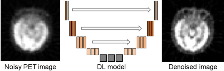 The Role of Artificial Intelligence in Advancing Theranostics Dosimetry for Cancer Therapy: a Review.
