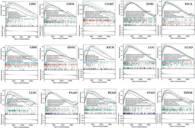 EIF5A2 acts as a potential marker for prognosis and immunity in human cancers.