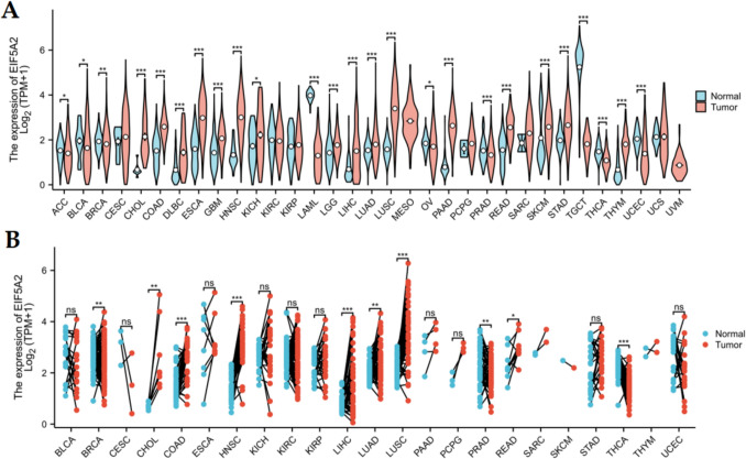EIF5A2 acts as a potential marker for prognosis and immunity in human cancers.