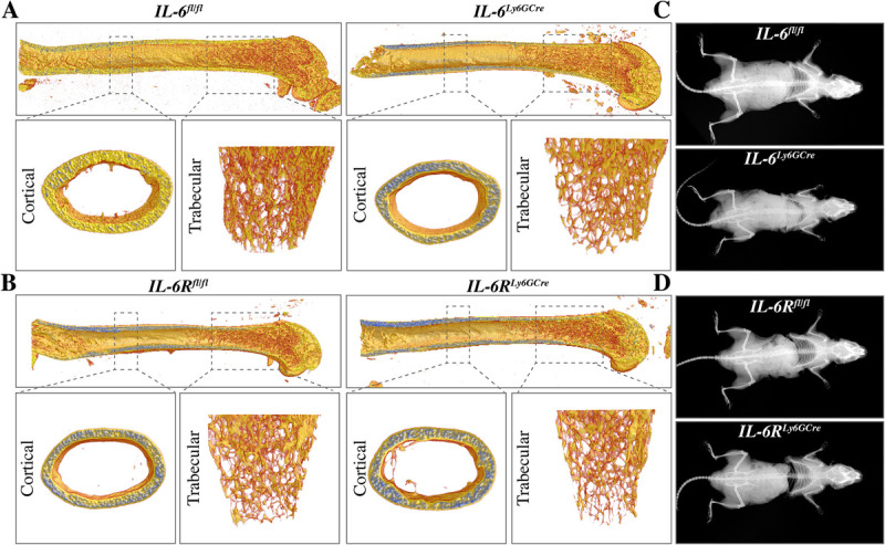 PHYSIOLOGICAL FRACTURE HEALING IS UNAFFECTED BY NEUTROPHIL-DERIVED IL-6 OR IL-6R SIGNALING IN MICE.