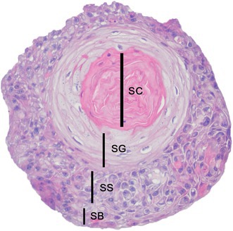 Evaluation of canine epidermis and keratinocytoids (keratinocytic organoids) by transmission electron microscopy.