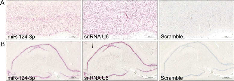 Application of microRNA In Situ Hybridization on Long-term Stored Human Formalin-fixed Paraffin-embedded Brain Samples from Psychiatric Patients.
