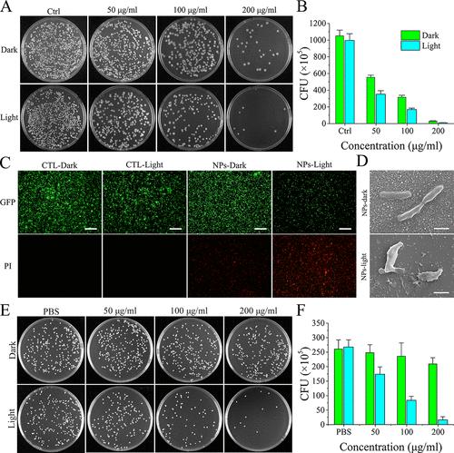 Correction to “Targeted Theranostics for Tuberculosis: A Rifampicin-Loaded Aggregation-Induced Emission Carrier for Granulomas Tracking and Anti-Infection”