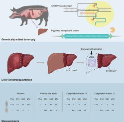 Genetically engineered pig-to-human liver xenotransplantation