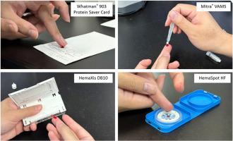 Analytical and usability comparison of microsampling dried blood spot devices for glucocorticoid detection in sports using ultra-high-performance liquid chromatography–tandem mass spectrometry
