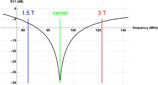 Toward accessible MRI: SDR4MR, a simple RF pulse monitoring technique using an inexpensive software-defined radio.