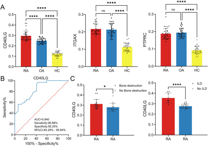 CD40LG as a Biomarker in Rheumatoid Arthritis: Links to Bone Destruction and Interstitial Lung Disease - A Bioinformatic Analysis With Clinical Validation