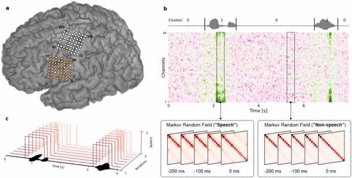 Real-time detection of spoken speech from unlabeled ECoG signals: a pilot study with an ALS participant.
