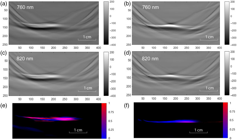 Handheld multispectral photoacoustic imaging for assessing myocardial metabolism.