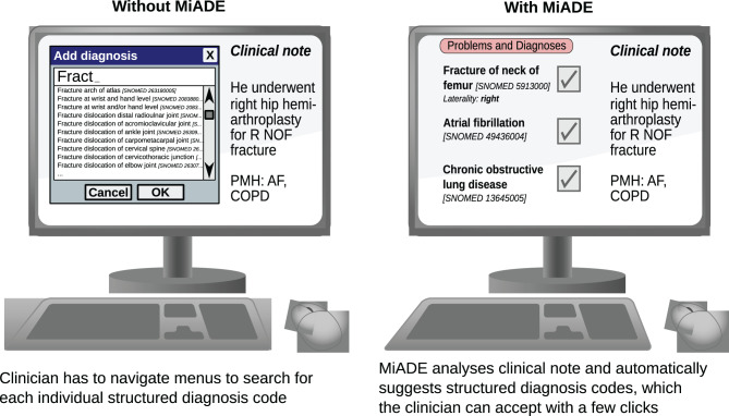 Design and implementation of a natural language processing system at the point of care: MiADE (medical information AI data extractor).