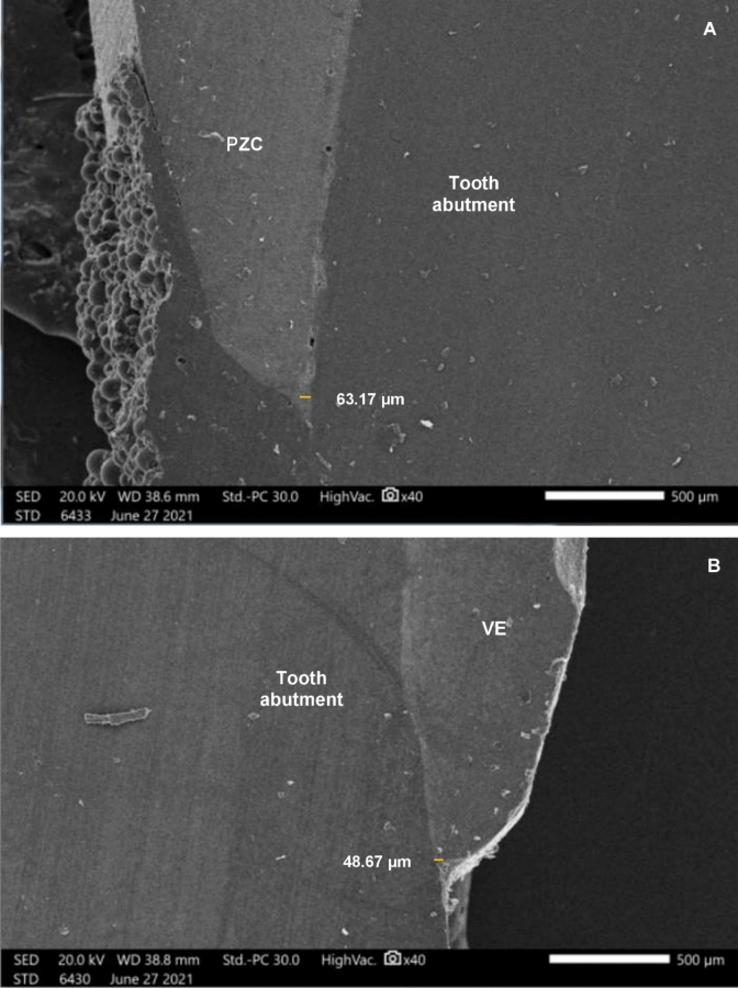 In vitro comparison of marginal fit between CAD/CAM hybrid ceramic crowns and prefabricated zirconia crowns for primary molars.