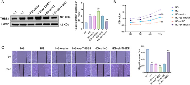 THBS1 regulates the function and insulin sensitivity of HTR8/SVneo cells treated with high glucose through the RhoA/ROCK1 signaling pathway.