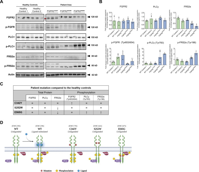 Generation of human induced pluripotent stem cell lines from patients with FGFR2-linked syndromic craniosynostosis.