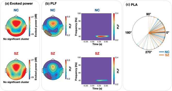 Abnormal spontaneous activity and rest-task shift in schizophrenia.