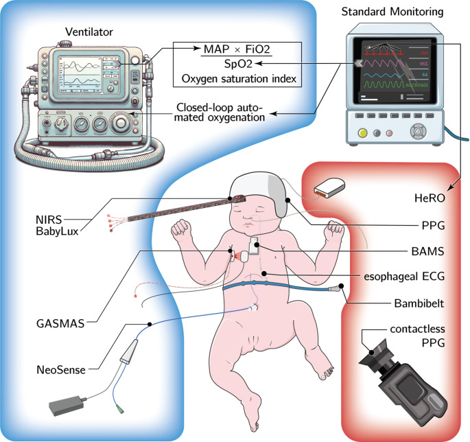 Future perspectives of heart rate and oxygenation monitoring in the neonatal intensive care unit - a narrative review.