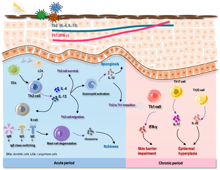Atopic dermatitis: diagnosis, molecular pathogenesis, and therapeutics.