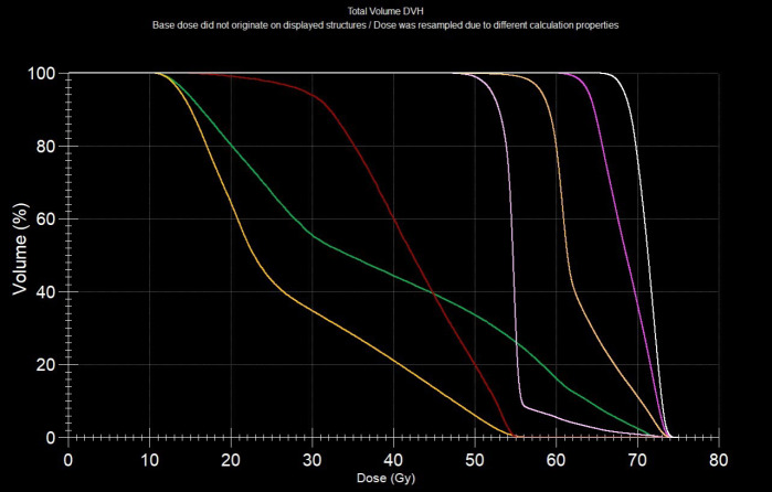 Radiation-induced Xerostomia: Evaluation with <sup>18</sup>F-FDG PET/CT.