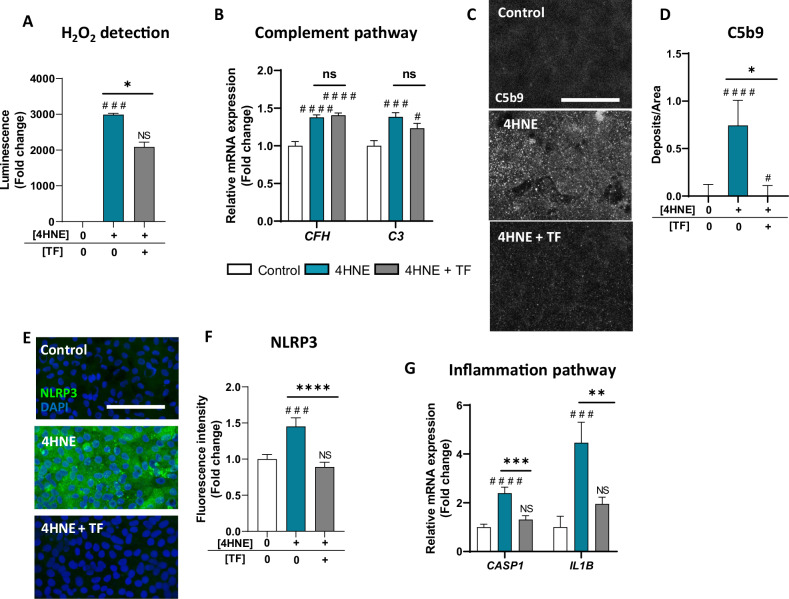 Transferrin is a drug candidate for the treatment of dry age-related macular degeneration (AMD).