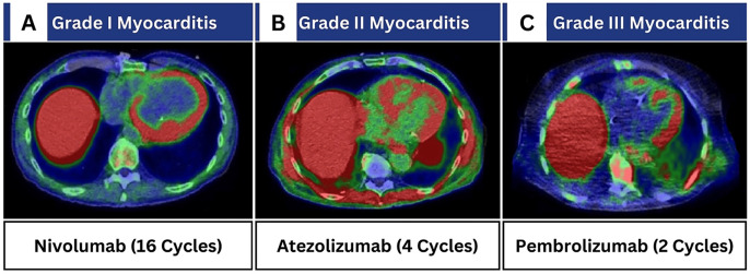 False Positive Findings of <sup>68</sup>Ga-DOTATOC PET/CT: A Systematic Review.
