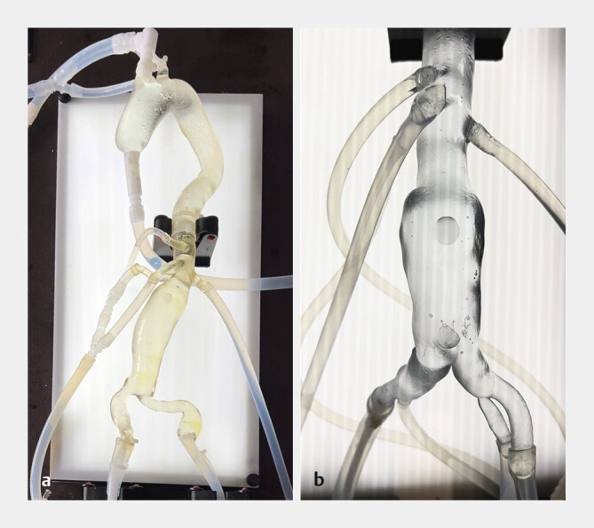 [Analogue vs. Digital: Gendered Perceptions of Endovascular Simulation-based Training].
