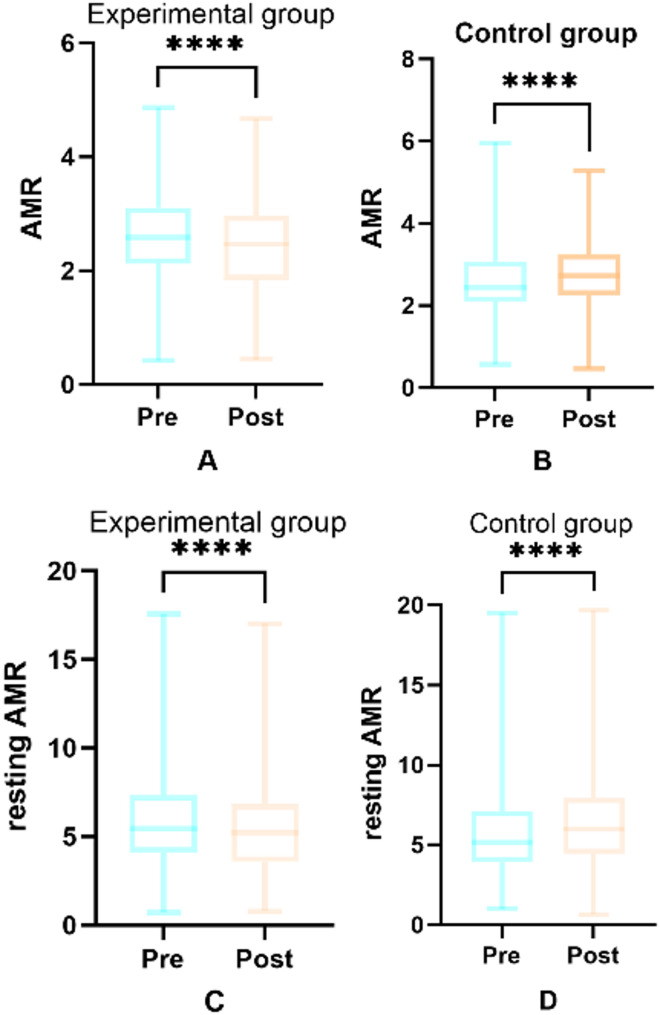 Effects of SGLT2 inhibitors on angiography-derived coronary microcirculatory resistance and clinical outcomes in patients with coronary heart disease and type 2 diabetes: A cohort study.