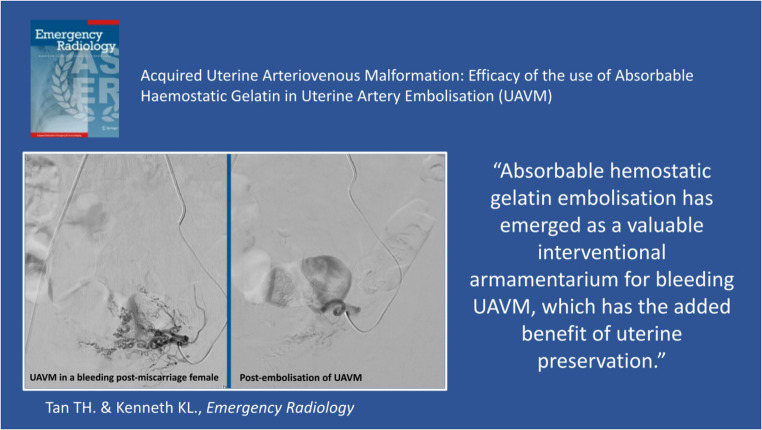 Acquired uterine arteriovenous malformation: efficacy of the use of absorbable haemostatic gelatin in uterine artery embolisation.