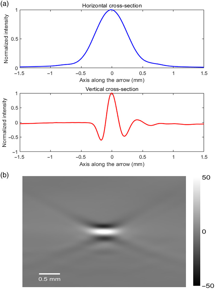 Handheld multispectral photoacoustic imaging for assessing myocardial metabolism.