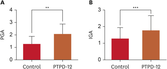 Efficacy and Safety of a PTPD-12-Containing Cream on Improvement in Hyperpigmentation: A Randomized, Split-Face Clinical Trial.