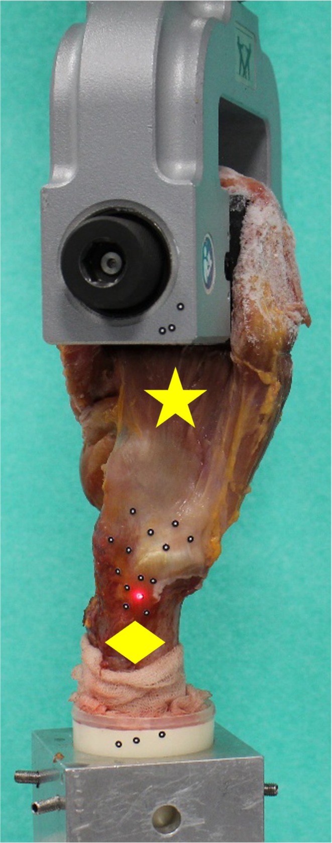 Superior Primary Stability of a Knotless Double-Row Construct Compared to Mason-Allen Repair for Anatomical Refixation of Gluteal Tendons-Biomechanical Human Cadaver Study.