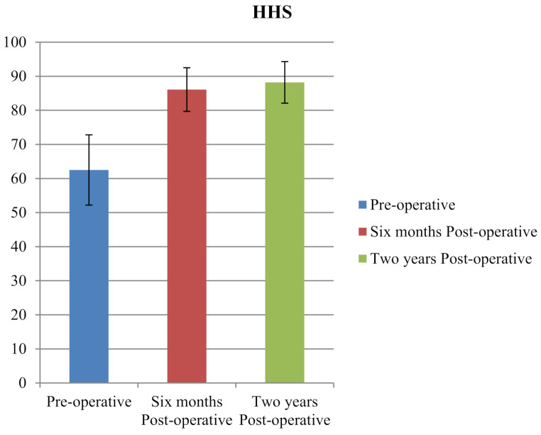 Femoral rotational osteotomy for posterior hip impingement in young adults with increased femoral version.