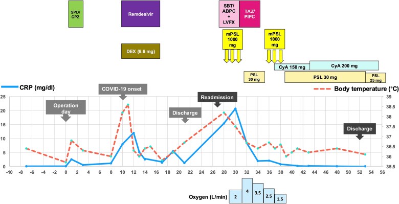 Delayed-onset organizing pneumonia following perioperative COVID-19 after lobectomy.