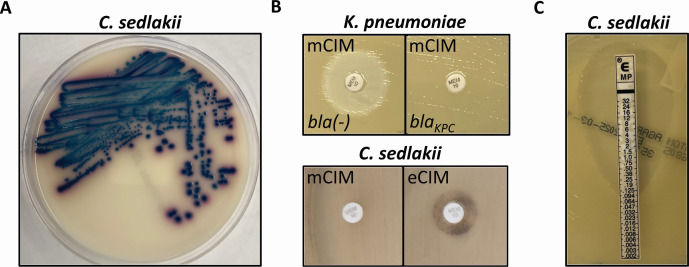 Paradoxical carbapenemase activity detected by modified carbapenemase inactivation (mCIM) method in <i>Citrobacter sedlakii</i>.