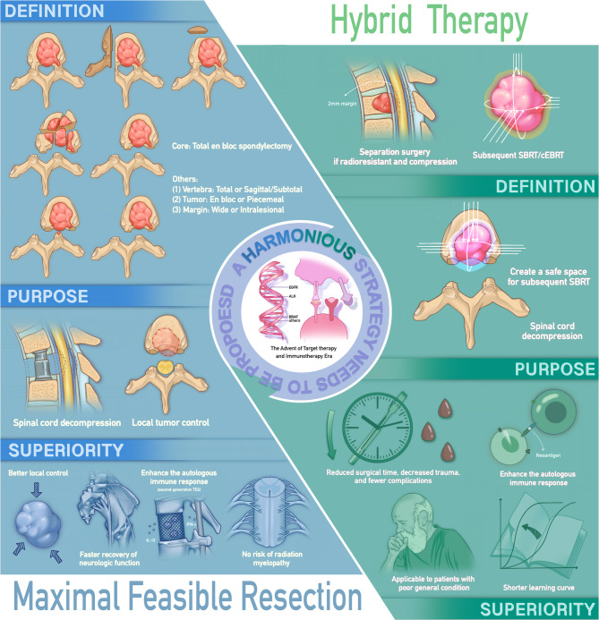 Maximal feasible resection versus hybrid therapy in spinal metastases: an updated narrative review.