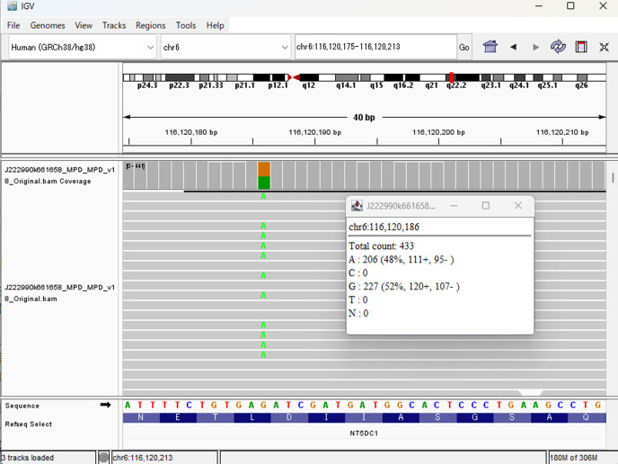 <i>COL10A1</i>-related metaphyseal dysplasia Schmid caused by the p.L644F variant in the <i>COL10A1</i> gene.