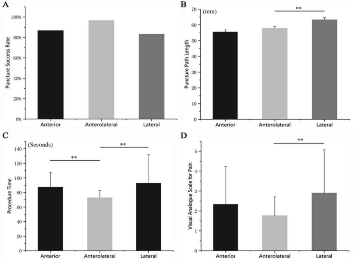 Comparison of the Clinical Efficacy of the Anterolateral and Regular Approaches for Hip Joint Puncture: A Randomized Cross-Over Trial.