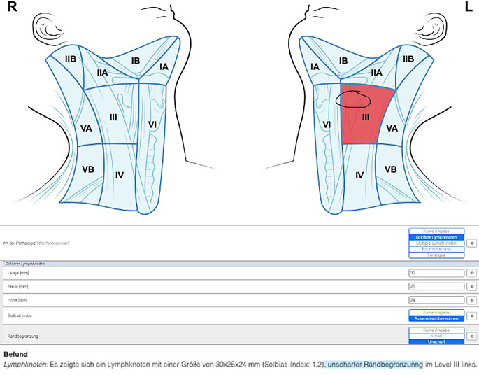 [Structured reporting in otorhinolaryngology].