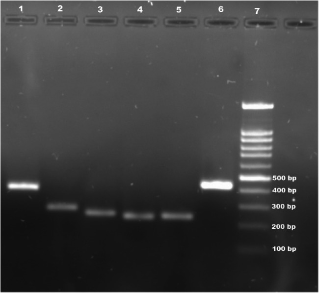 FimA genotype variants of Porphyromonas gingivalis in periodontal health and disease: a preliminary observational study among the UAE population.