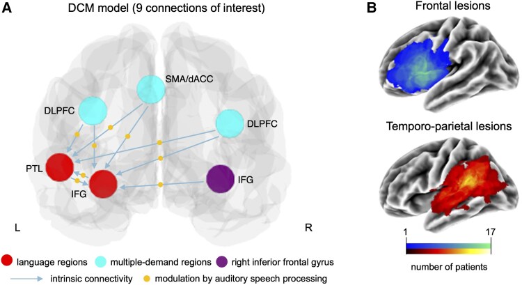 Dynamic reorganization of task-related network interactions in post-stroke aphasia recovery.