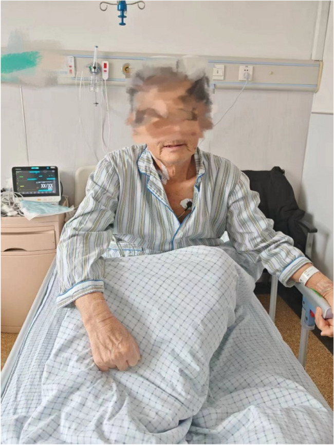 Successful management with hemoperfusion and antidotal therapy of severe combined dichlorvos and rodenticide poisoning: a case report.