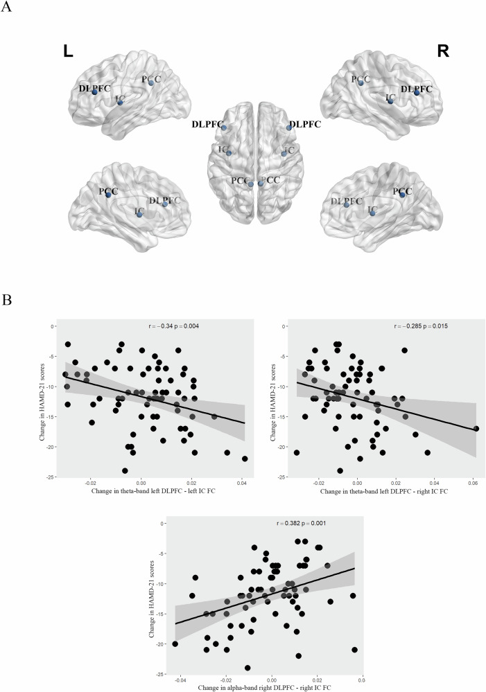 Early treatment-related changes in dorsolateral prefrontal cortex activity and functional connectivity as potential biomarkers for antidepressant response in major depressive disorder.