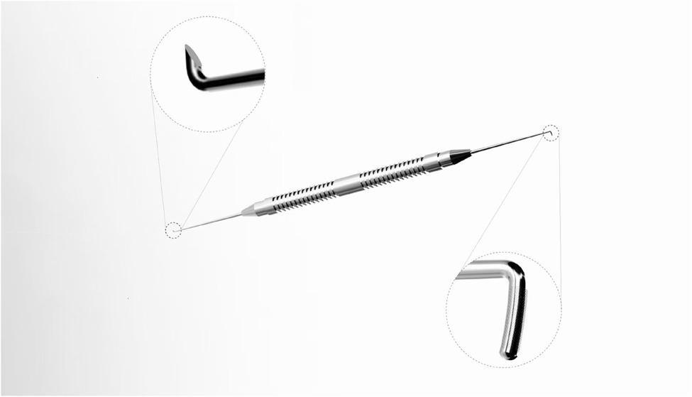 Clinical outcomes of LAN microhook-assisted goniotomy combined with phacoemulsification in mid-to-late primary angle-closure glaucoma with cataract.