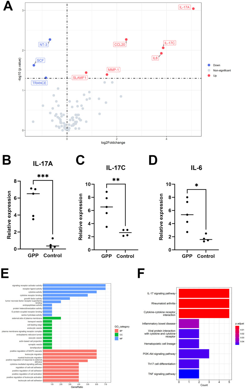 Clinical Features, Treatment Effectiveness and Long-Term Outcomes in Children with Moderate-to-Severe Generalized Pustular Psoriasis: A Retrospective Cohort Study.