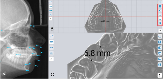 Orthodontic diagnosis and usability of the web-based e-learning application orthotrainer.