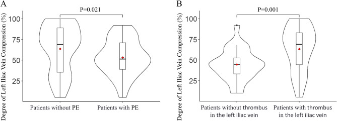 The dual role of Iliac vein compression in the occurrence of pulmonary embolism.