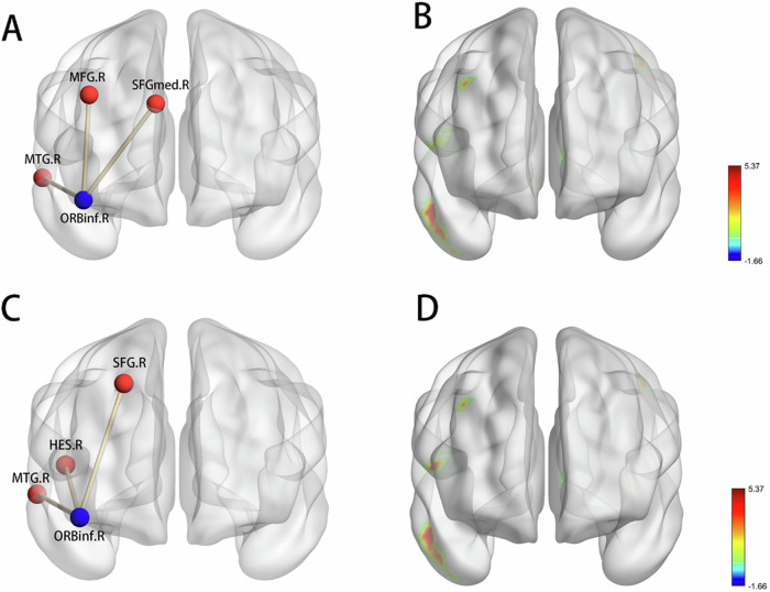 Orbitofrontal functional network: the mediating role between violence and childhood trauma in patients with schizophrenia.