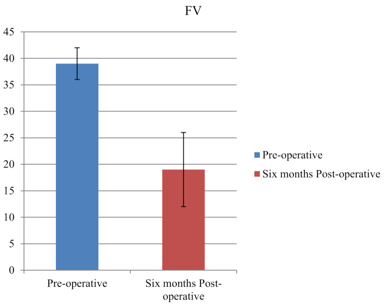 Femoral rotational osteotomy for posterior hip impingement in young adults with increased femoral version.